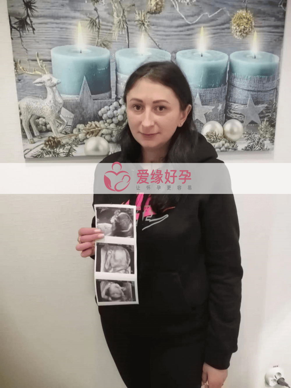 乌克兰试管婴儿助孕爱心妈妈20周产检顺利通过！