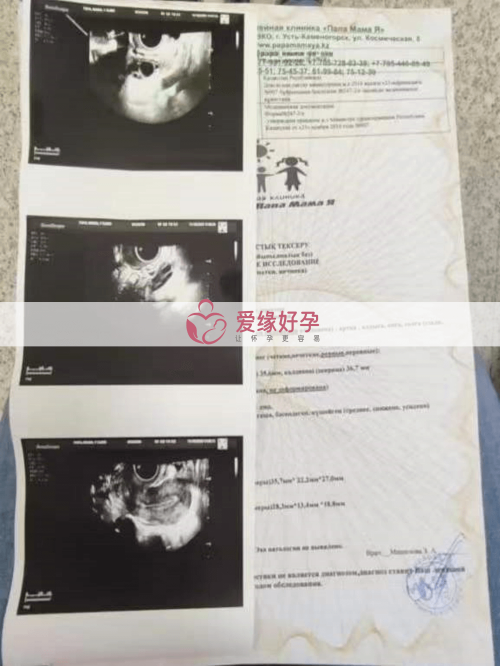 哈萨克斯坦代孕代孕代母6周产检通过！