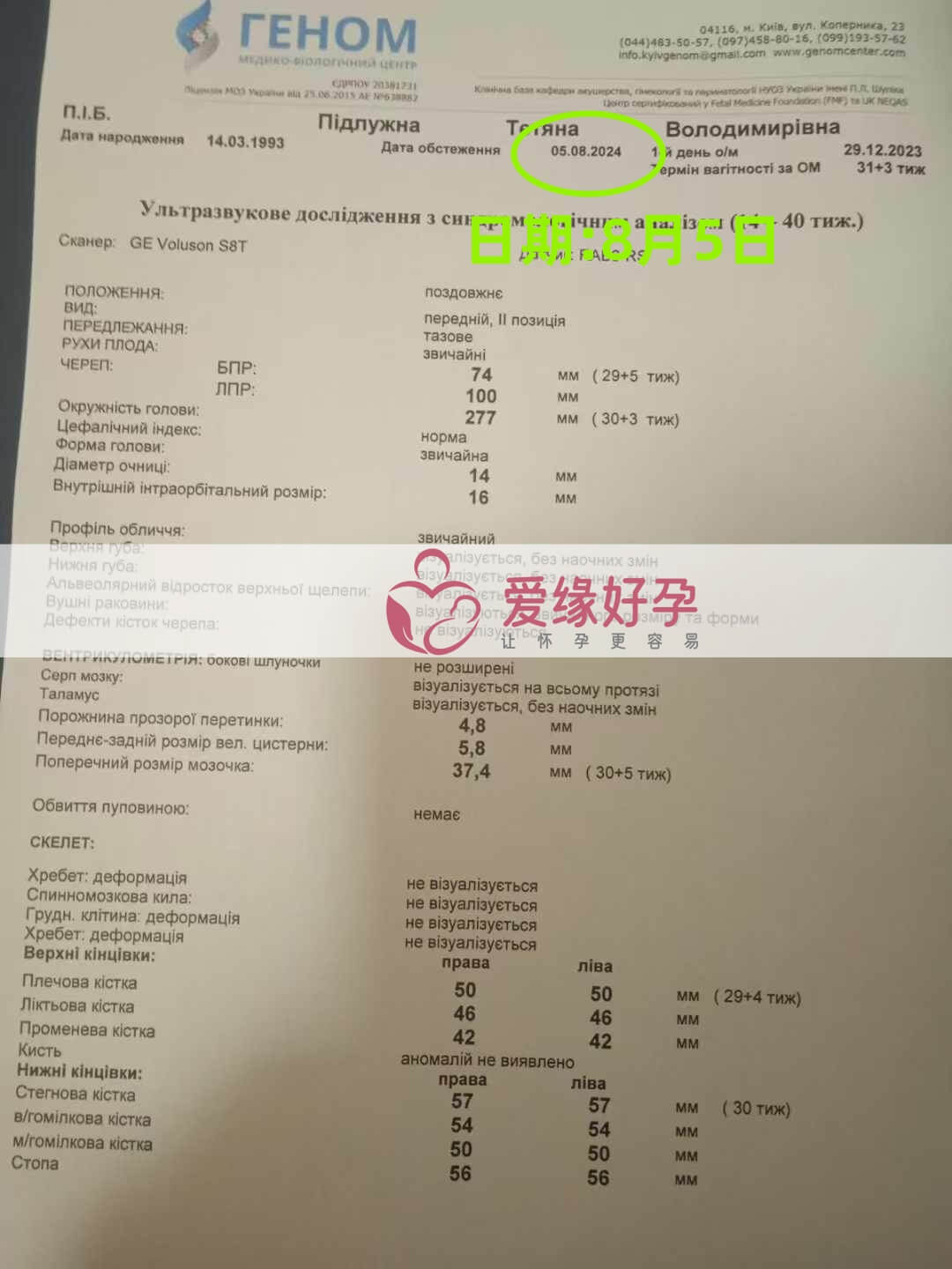 爱缘好孕乌克兰爱心志愿者30周孕检通过！