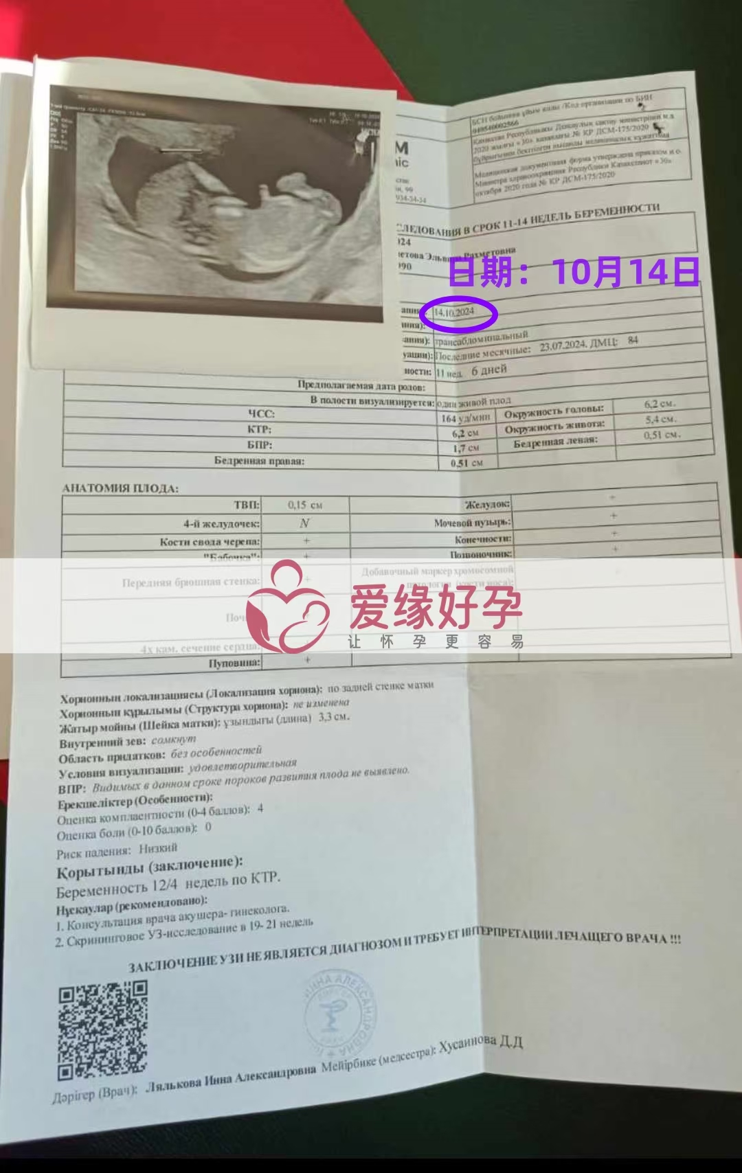 哈萨克斯坦爱心使者孕12周产检顺利通过