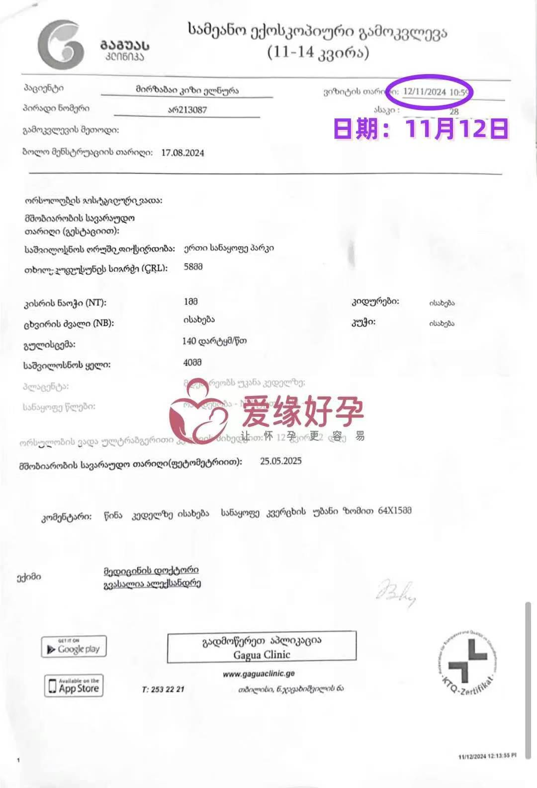 格鲁吉亚爱心使者12周NT检测顺利通过