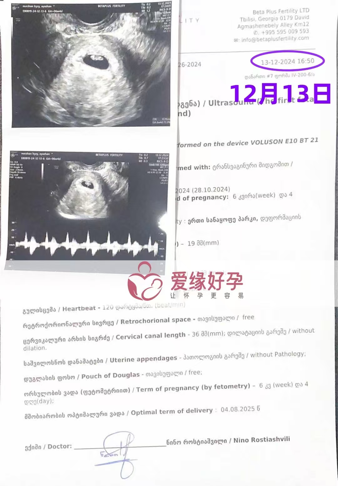 格鲁吉亚爱心使者孕6周产检顺利通过