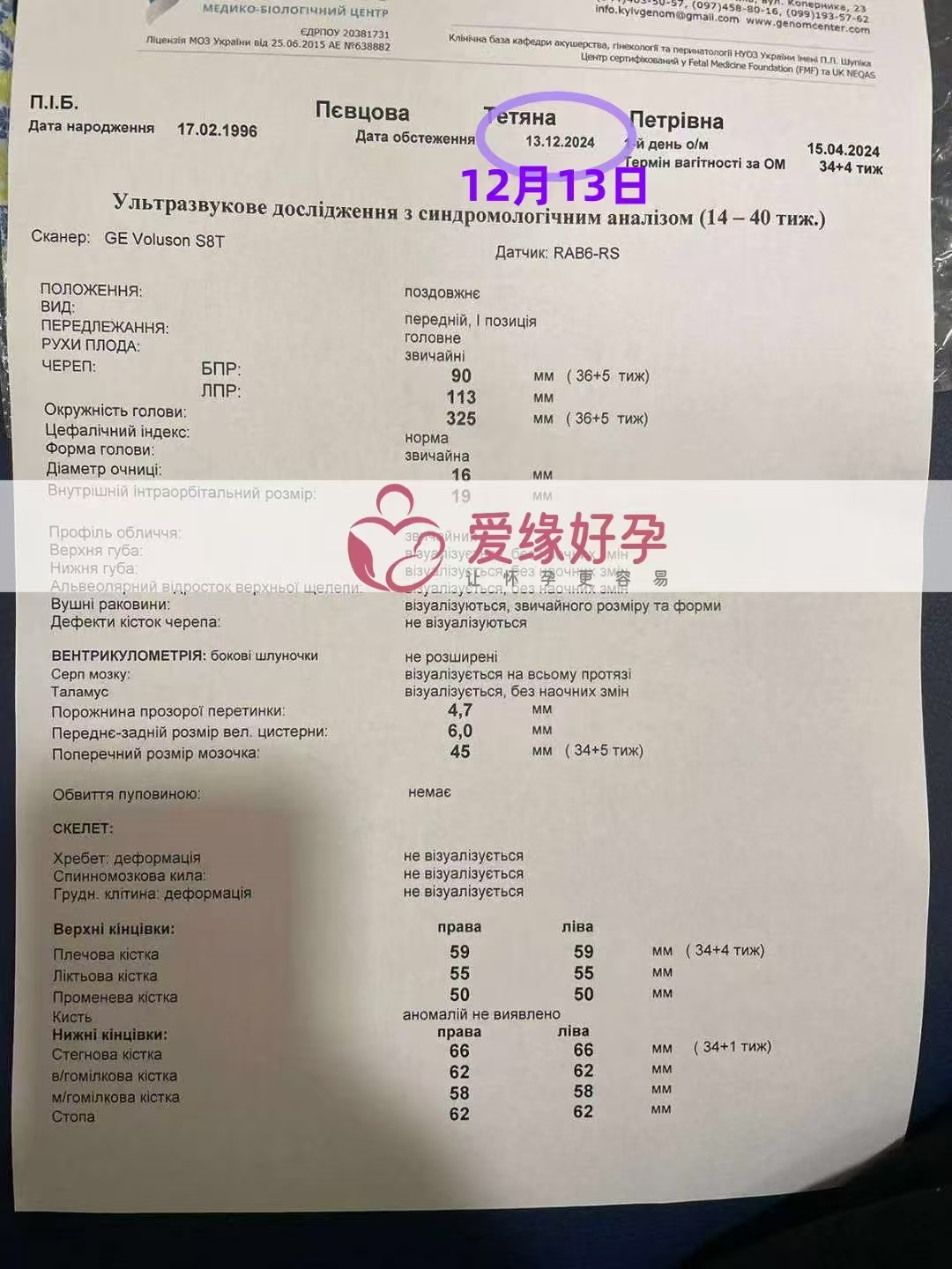 乌克兰爱心使者孕34周产检顺利通过