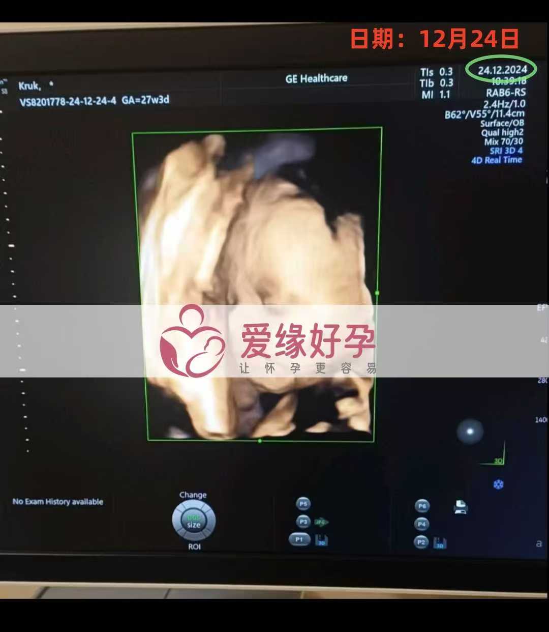 乌克兰爱心使者孕27周产检顺利通过