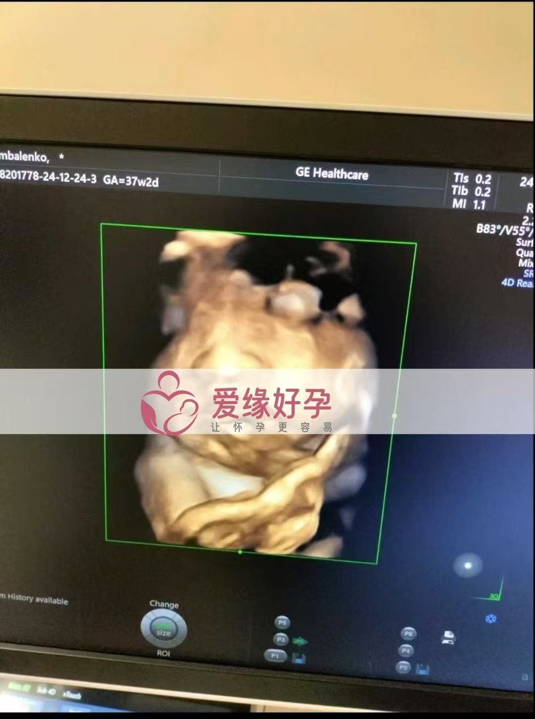 乌克兰爱心使者孕37周产检顺利通过