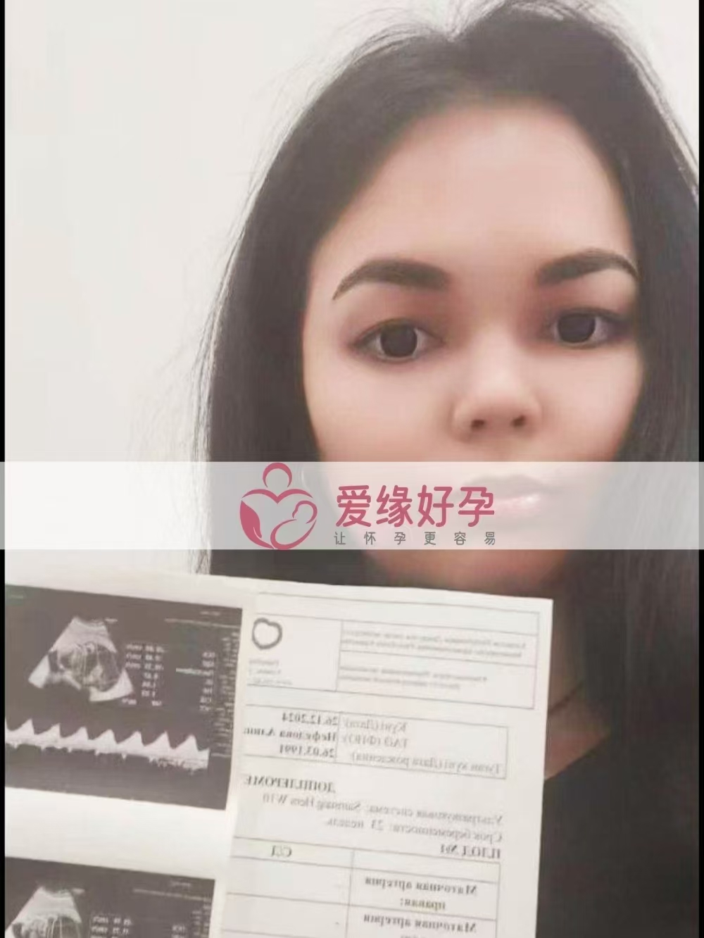 哈萨克斯坦爱心使者孕23周产检顺利通过