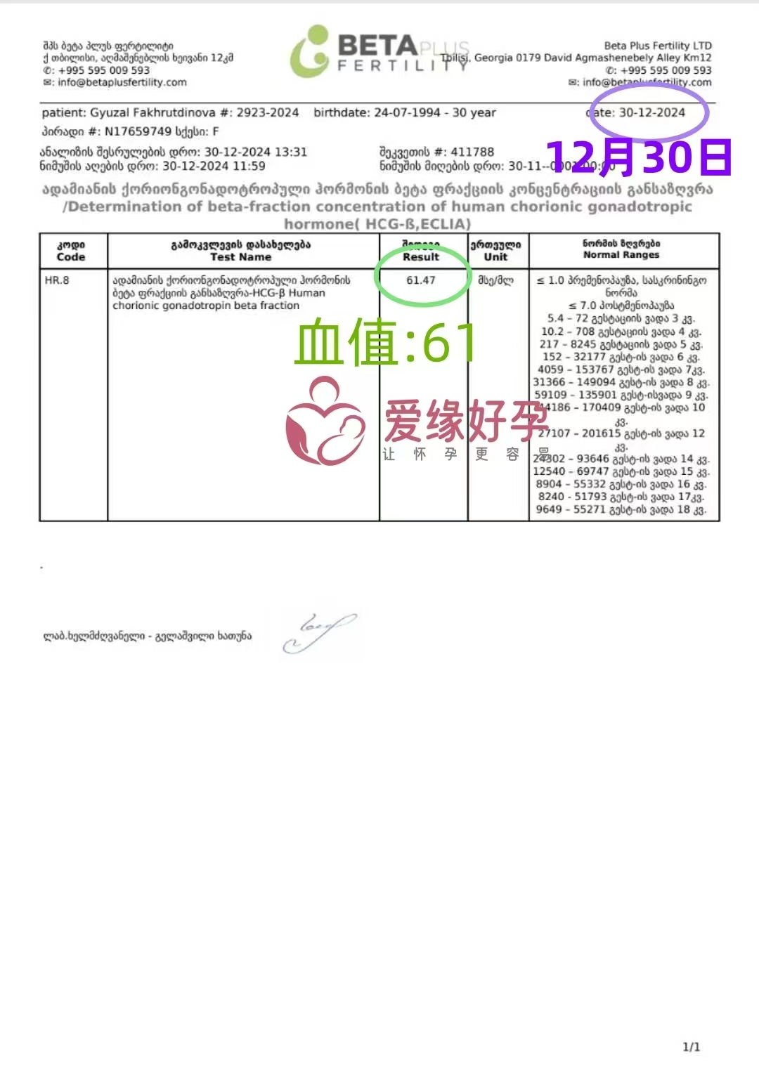 格鲁吉亚爱心使者验孕成功