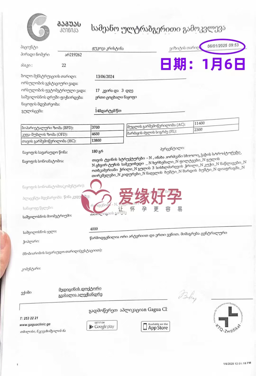 格鲁吉亚爱心使者孕17周产检顺利通过