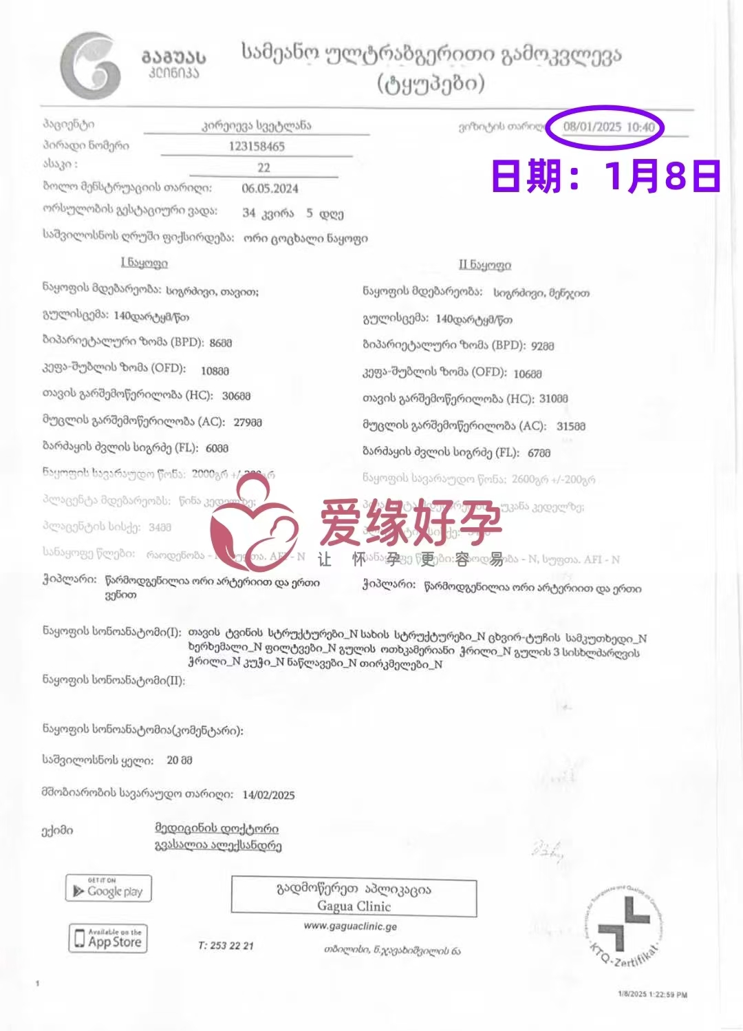 格鲁吉亚爱心使者孕34周+5天产检顺利通过