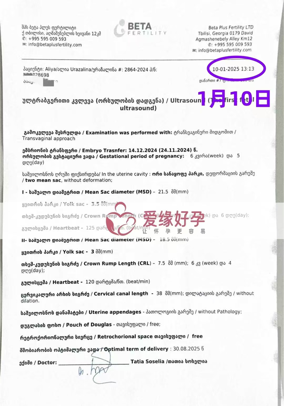 格鲁吉亚爱心使者第一次B超验孕双胎成功
