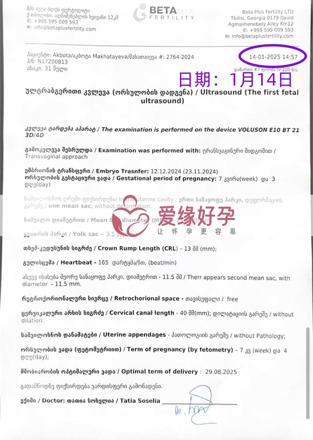 格鲁吉亚爱心使者孕7周产检顺利通过