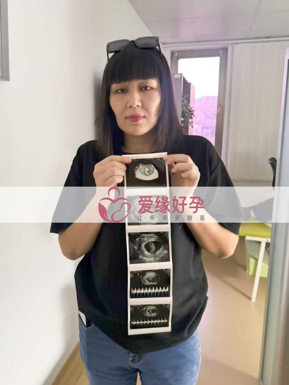 格鲁吉亚爱心使者双胞胎孕9周产检顺利通过