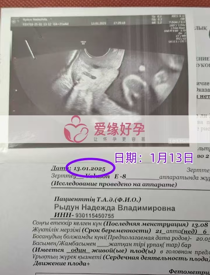 格鲁吉亚爱心使者孕21周产检顺利通过