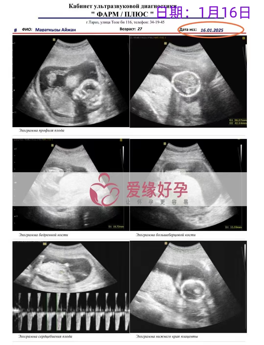 格鲁吉亚爱心使者孕16周产检顺利通过