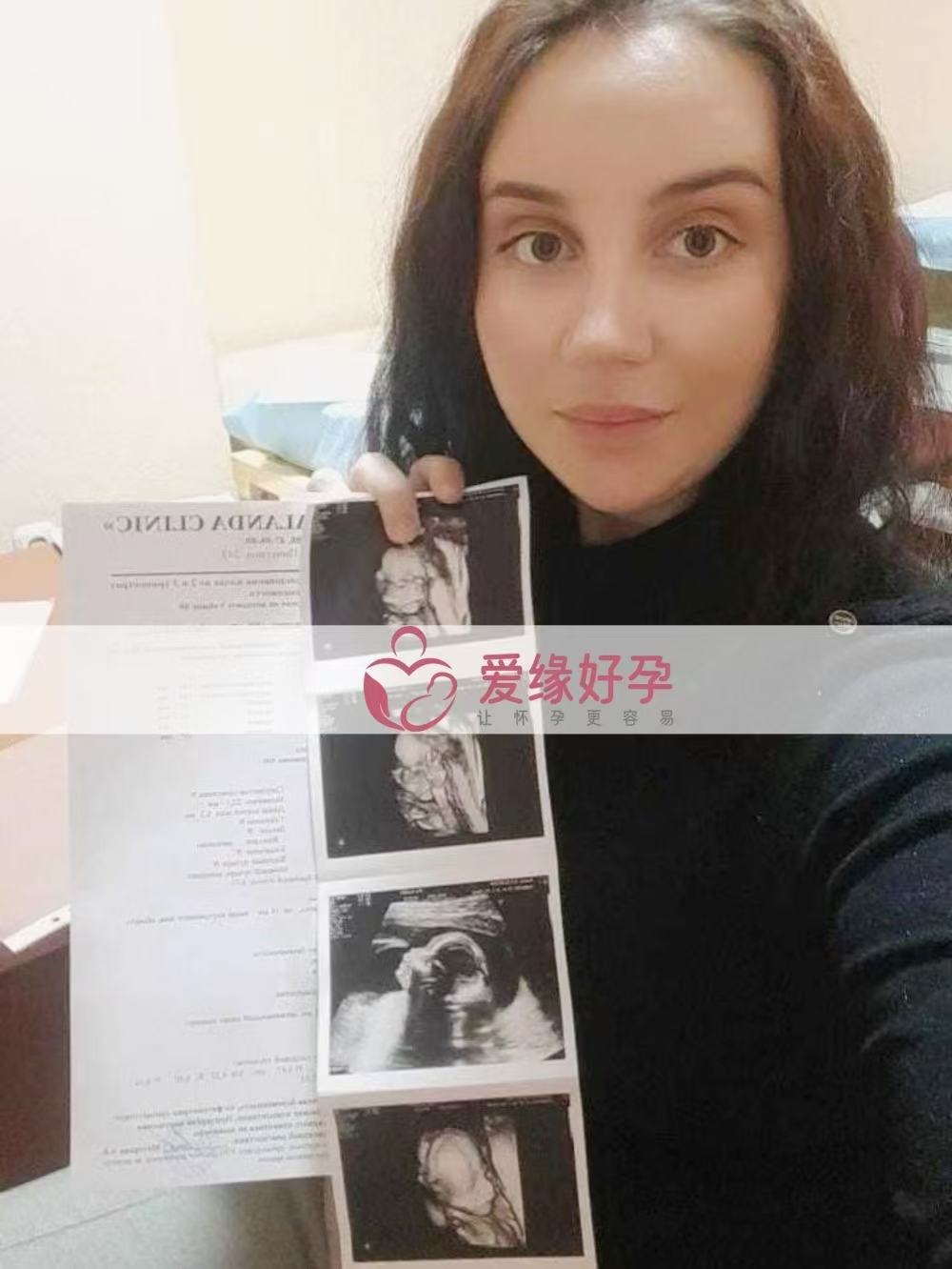 哈萨克斯坦爱心使者孕21周产检顺利通过