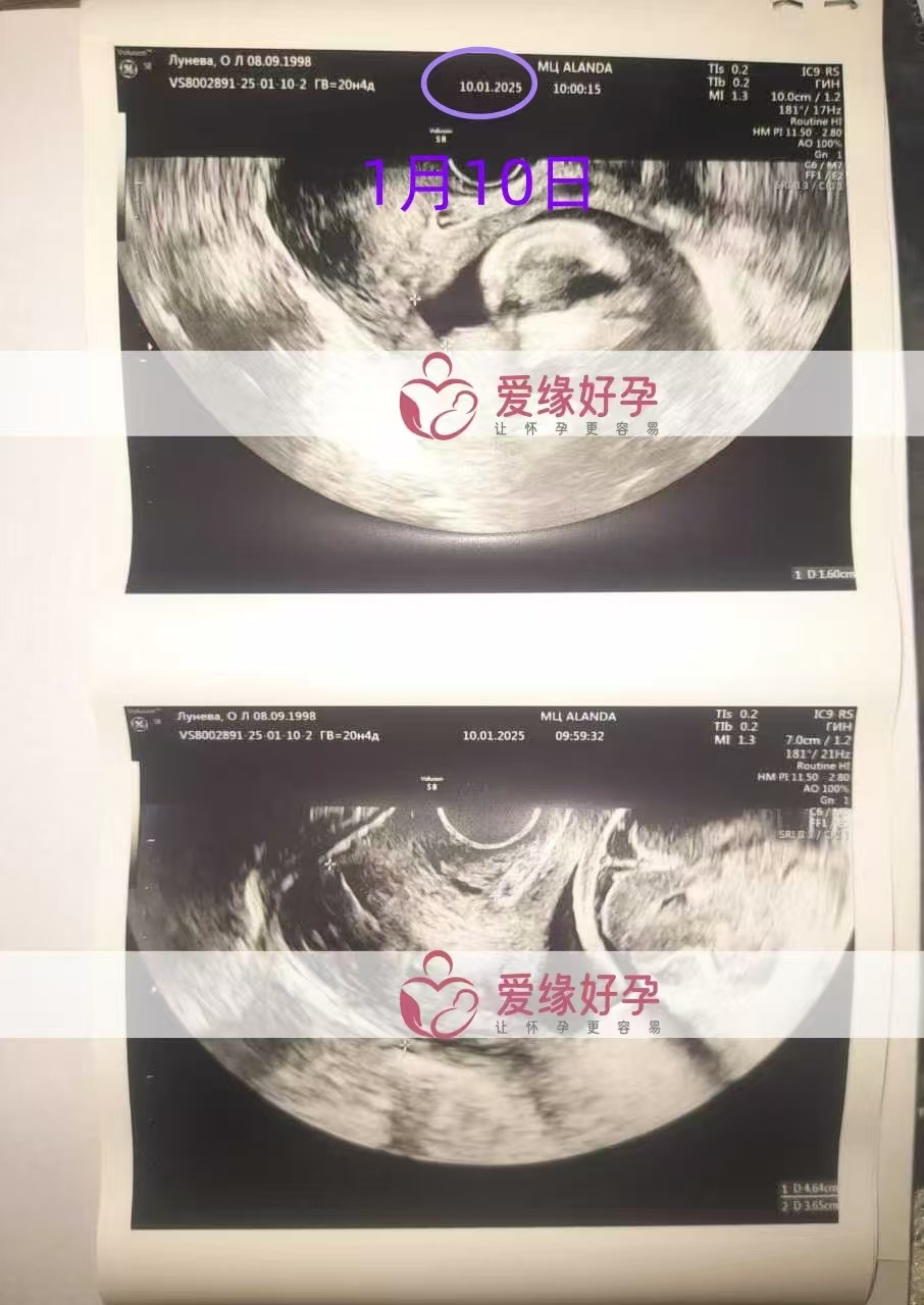 哈萨克斯坦爱心使者孕21周产检顺利通过