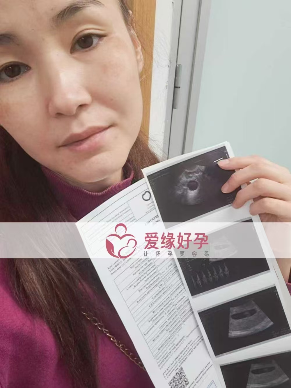 格鲁吉亚试管婴儿助孕爱心使者6周产检顺利通过，血值高达1253