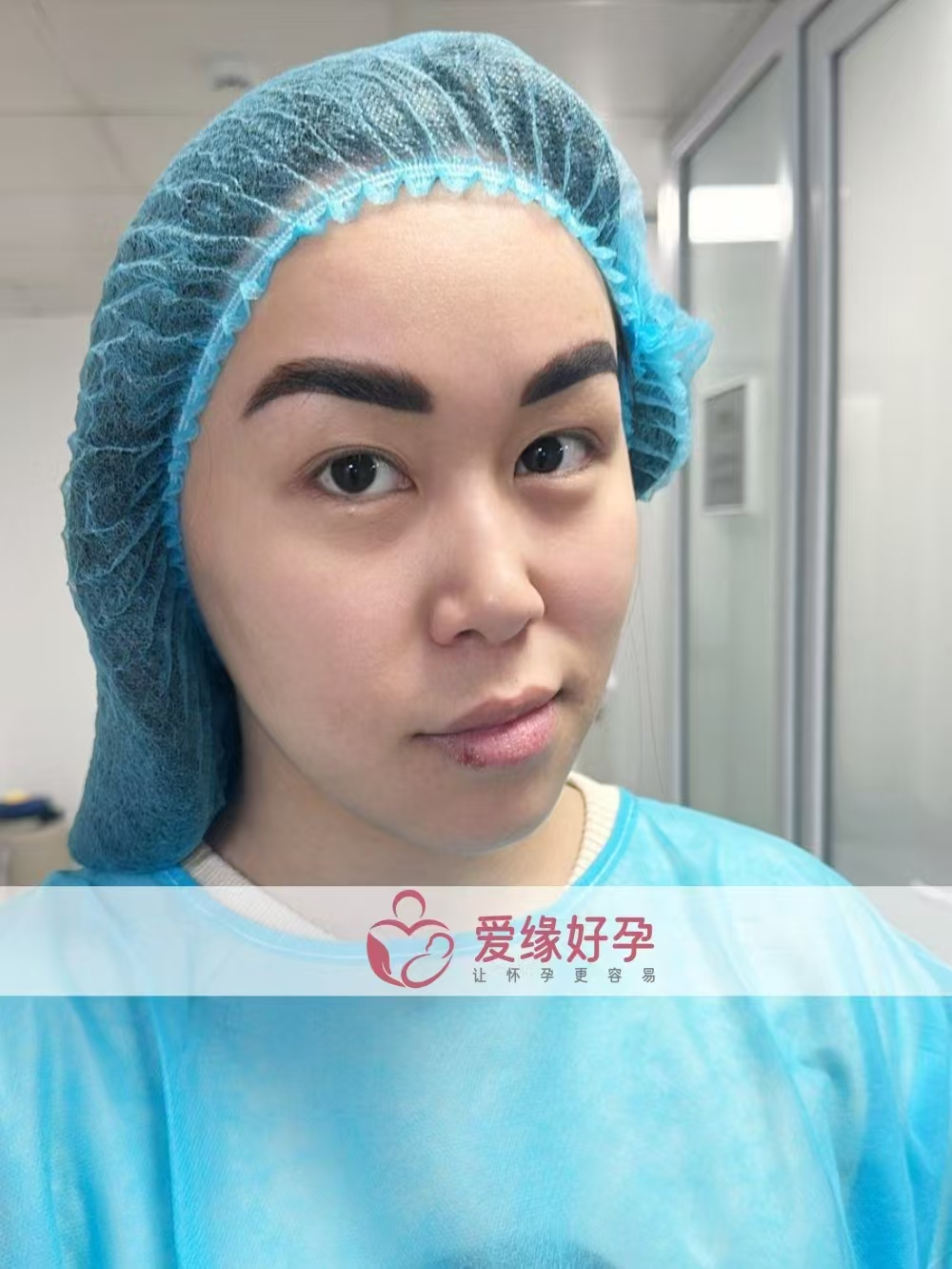 格鲁吉亚试管婴儿助孕爱心使者成功完成移植