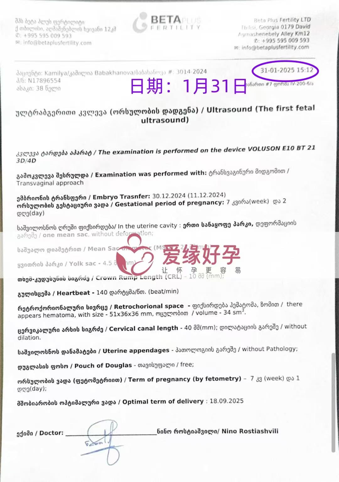 格鲁吉亚爱缘好孕恩泽试管婴儿助孕爱心使者7周产检顺利通过