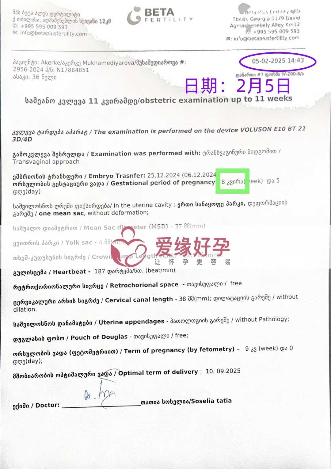 格鲁吉亚试管婴儿助孕爱心使者8周产检进展顺利