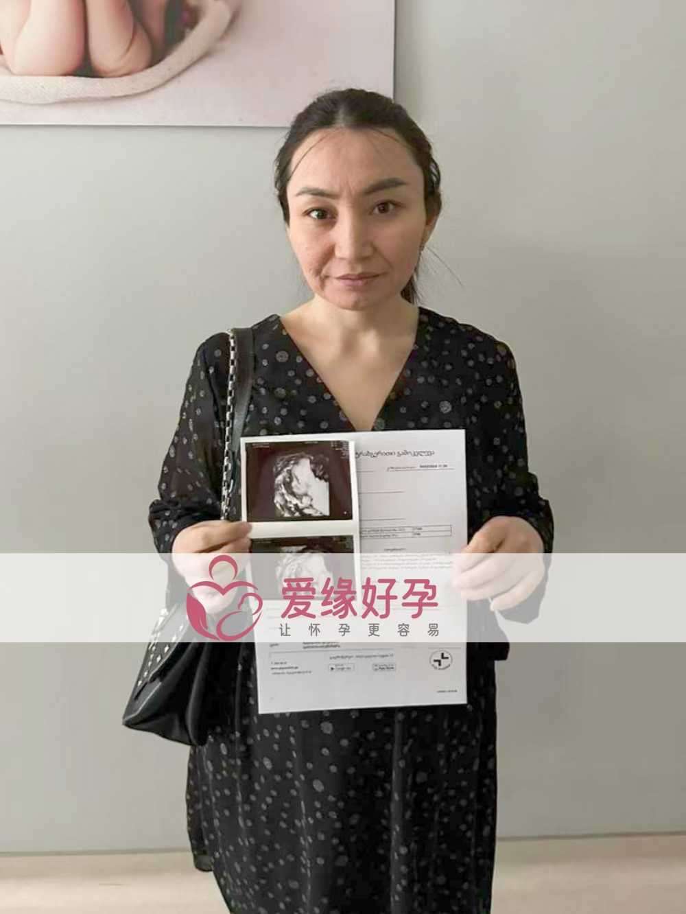 格鲁吉亚试管婴儿助孕爱心使者顺利通过21周产检