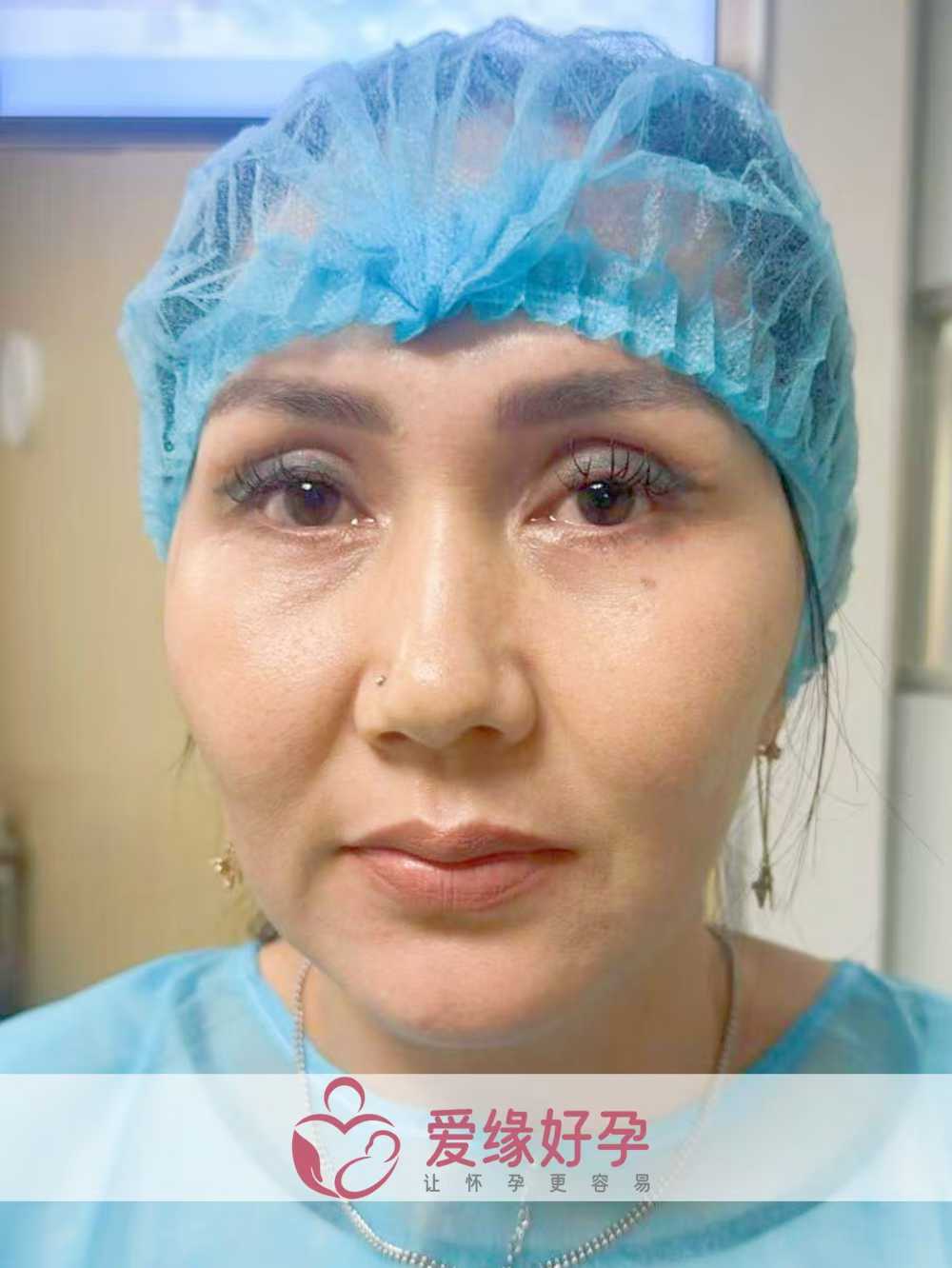 格鲁吉亚试管婴儿助孕爱心使者成功完成移植