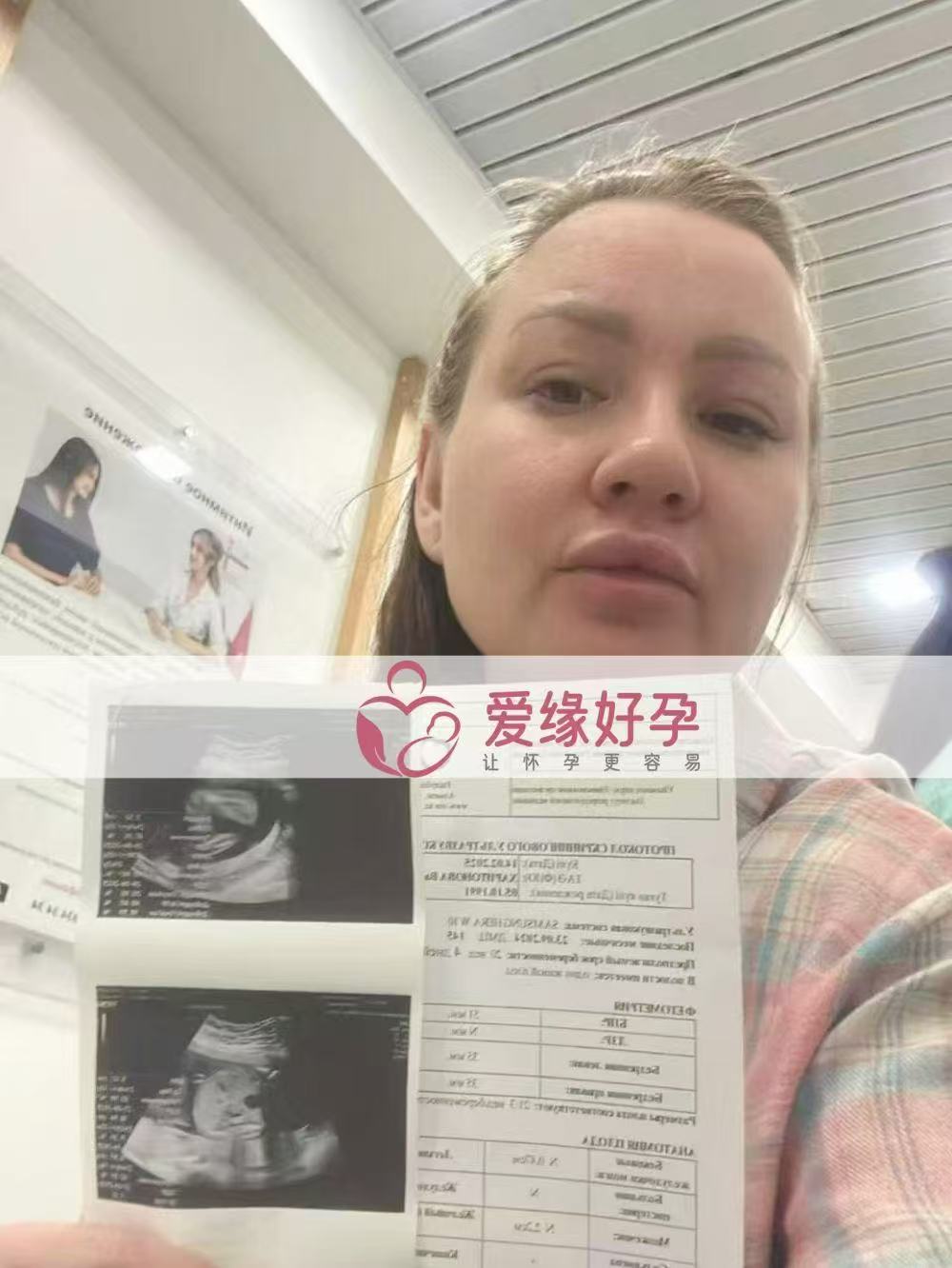 哈萨克斯坦试管婴儿助孕爱心使者20周产检顺利通过