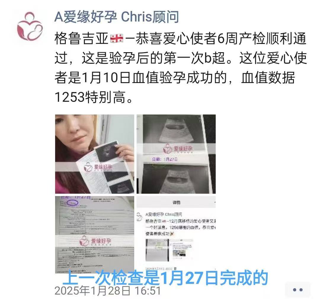 格鲁吉亚试管婴儿助孕爱心使者14周产检结果安好