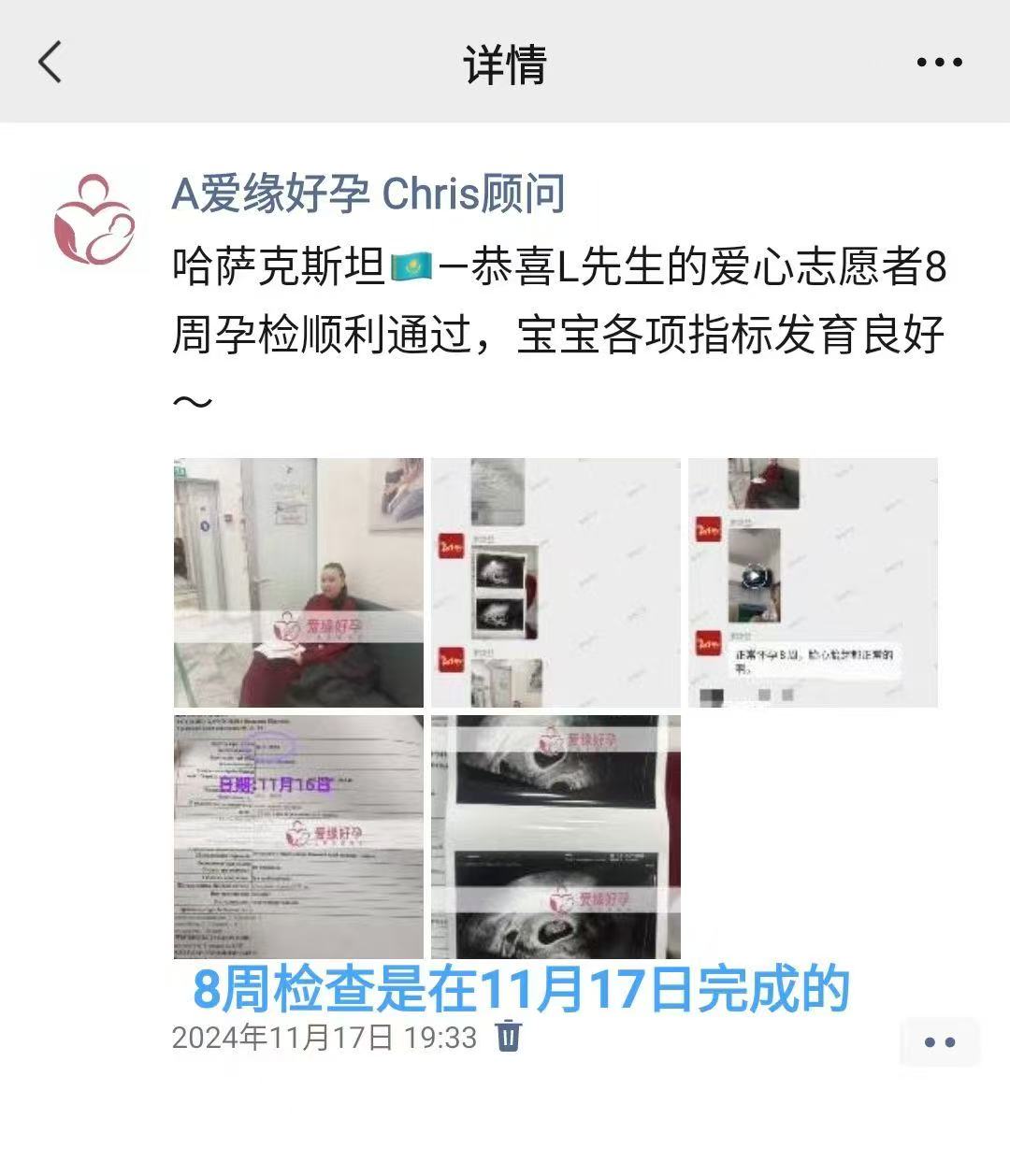 哈萨克斯坦试管婴儿助孕爱心使者20周产检顺利通过