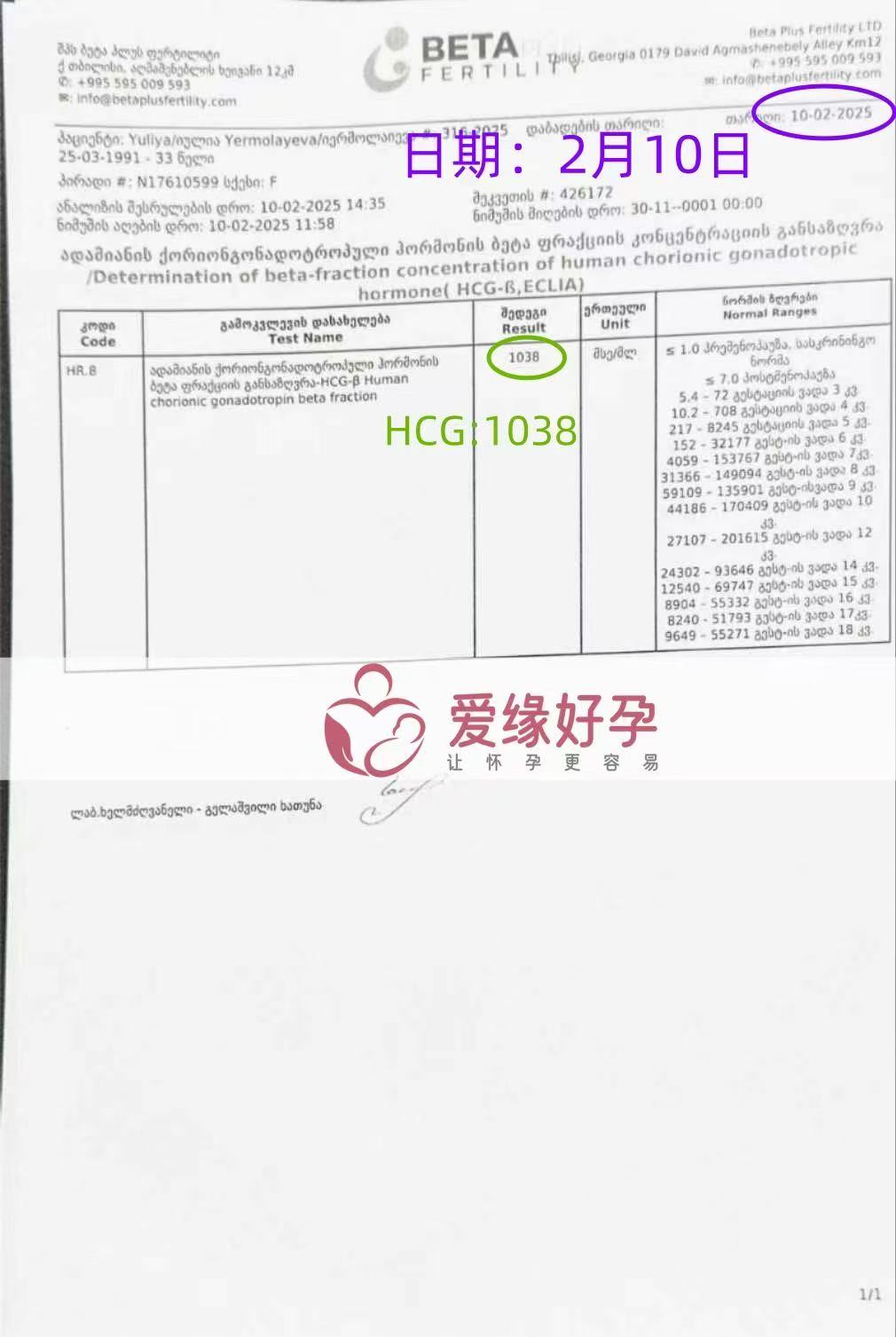 格鲁吉亚试管婴儿助孕爱心使者胚胎成功发芽