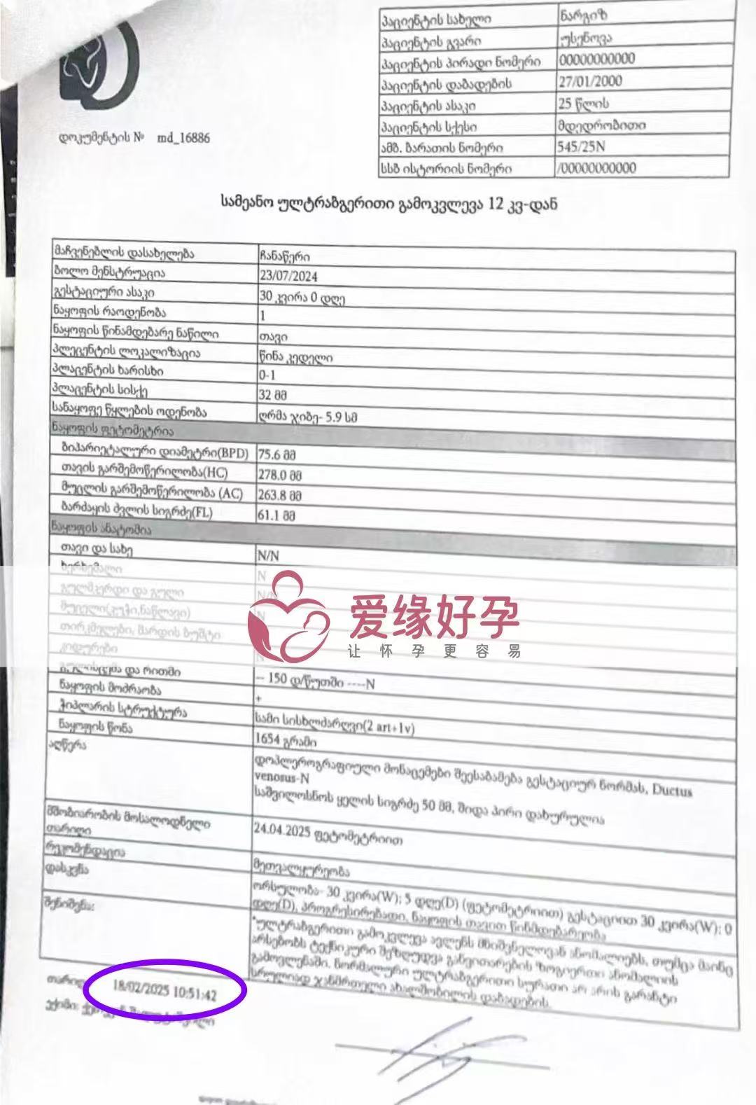 格鲁吉亚试管婴儿助孕爱心使者30周产检顺利通过
