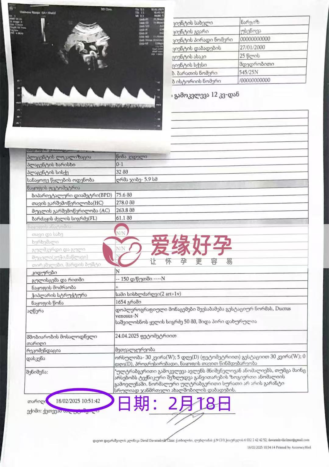 格鲁吉亚试管婴儿助孕爱心使者30周产检顺利通过
