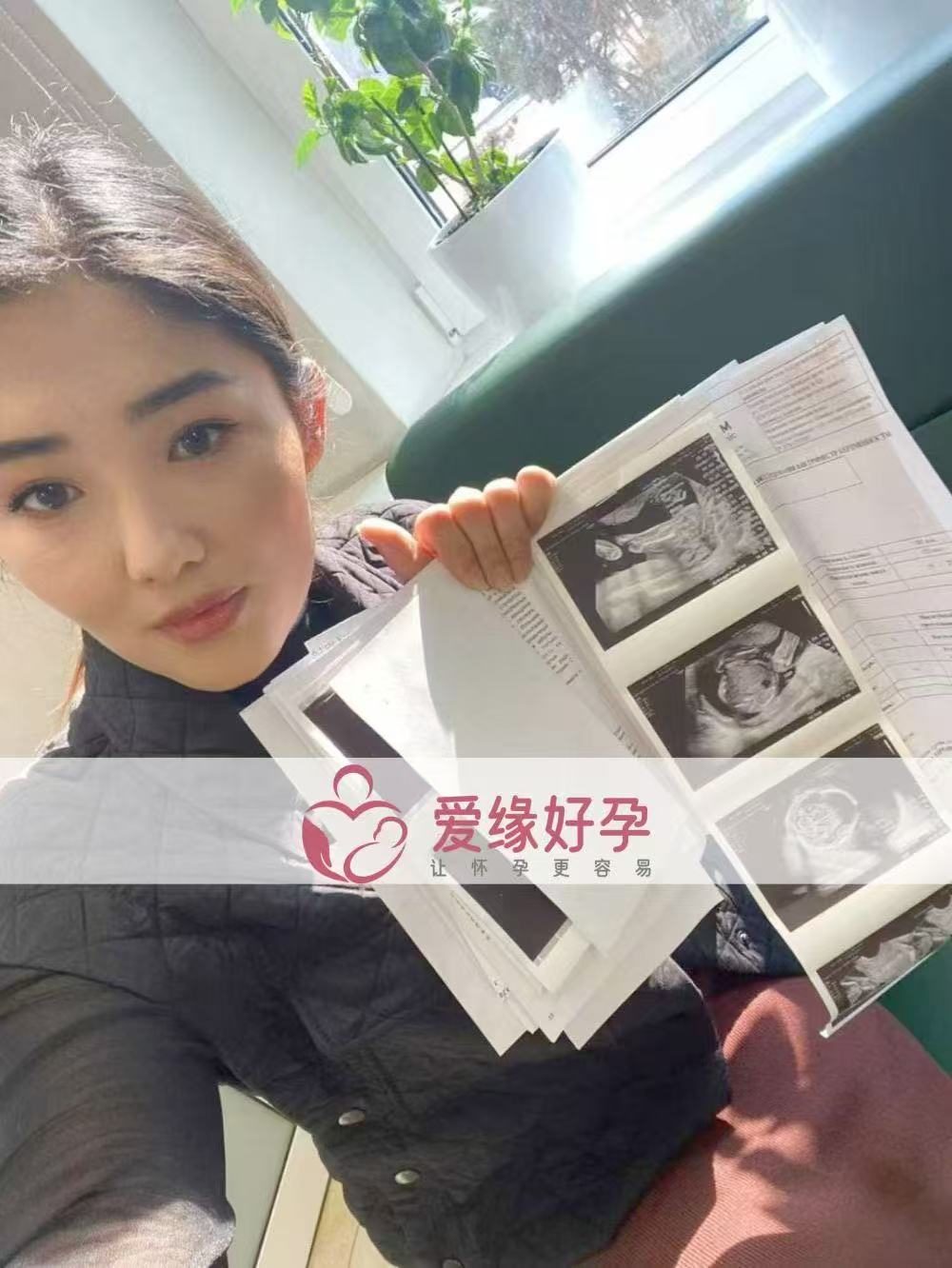 哈萨克斯坦试管婴儿助孕爱心使者20周产检顺利通过