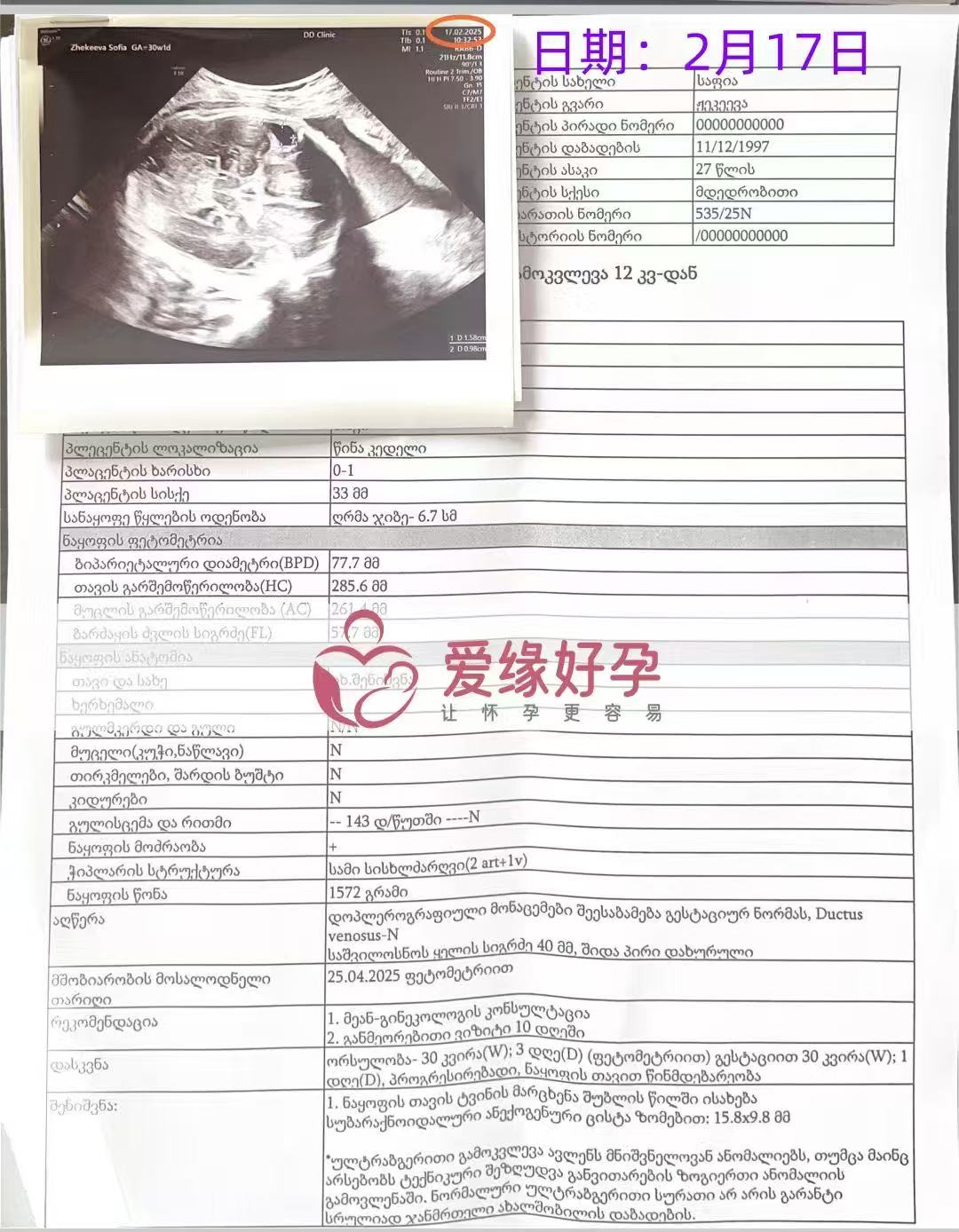 格鲁吉亚试管婴儿助孕爱心使者30周产检顺利通过