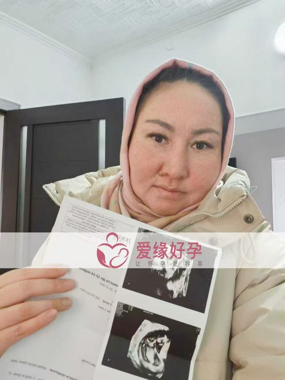格鲁吉亚试管婴儿助孕双胎爱心使者12周产检顺利通过