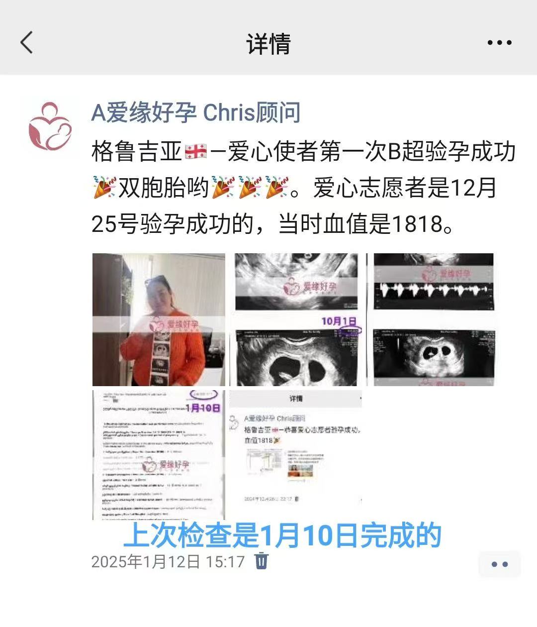 格鲁吉亚试管婴儿助孕双胎爱心使者12周产检顺利通过