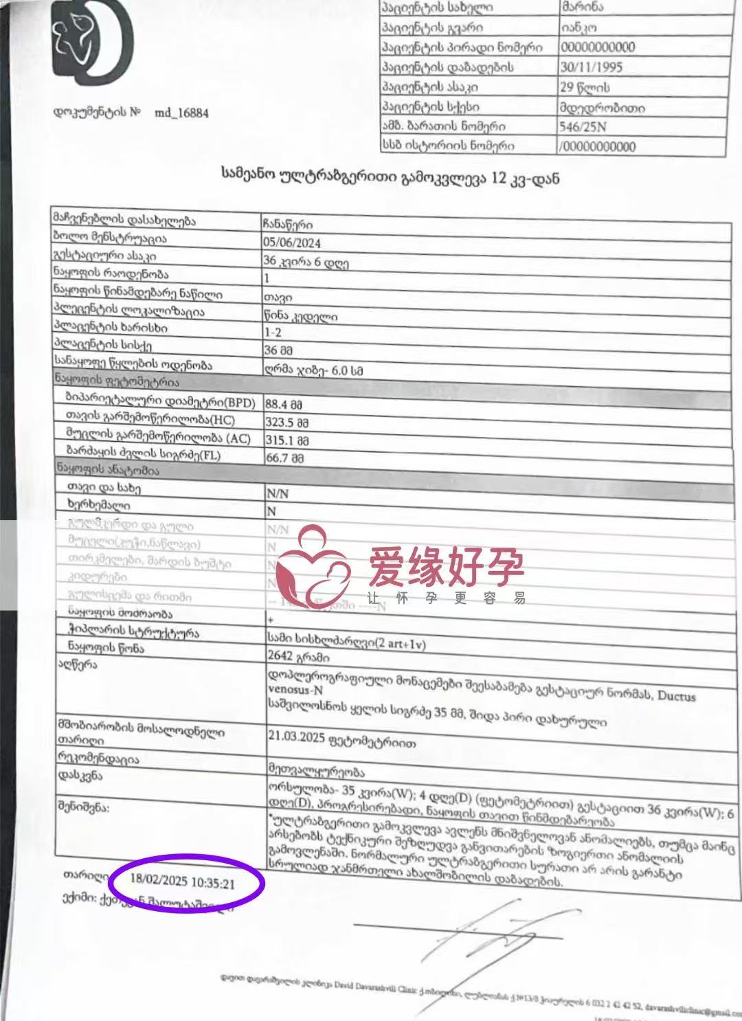 格鲁吉亚试管婴儿助孕爱心使者即将迎接新生命诞生