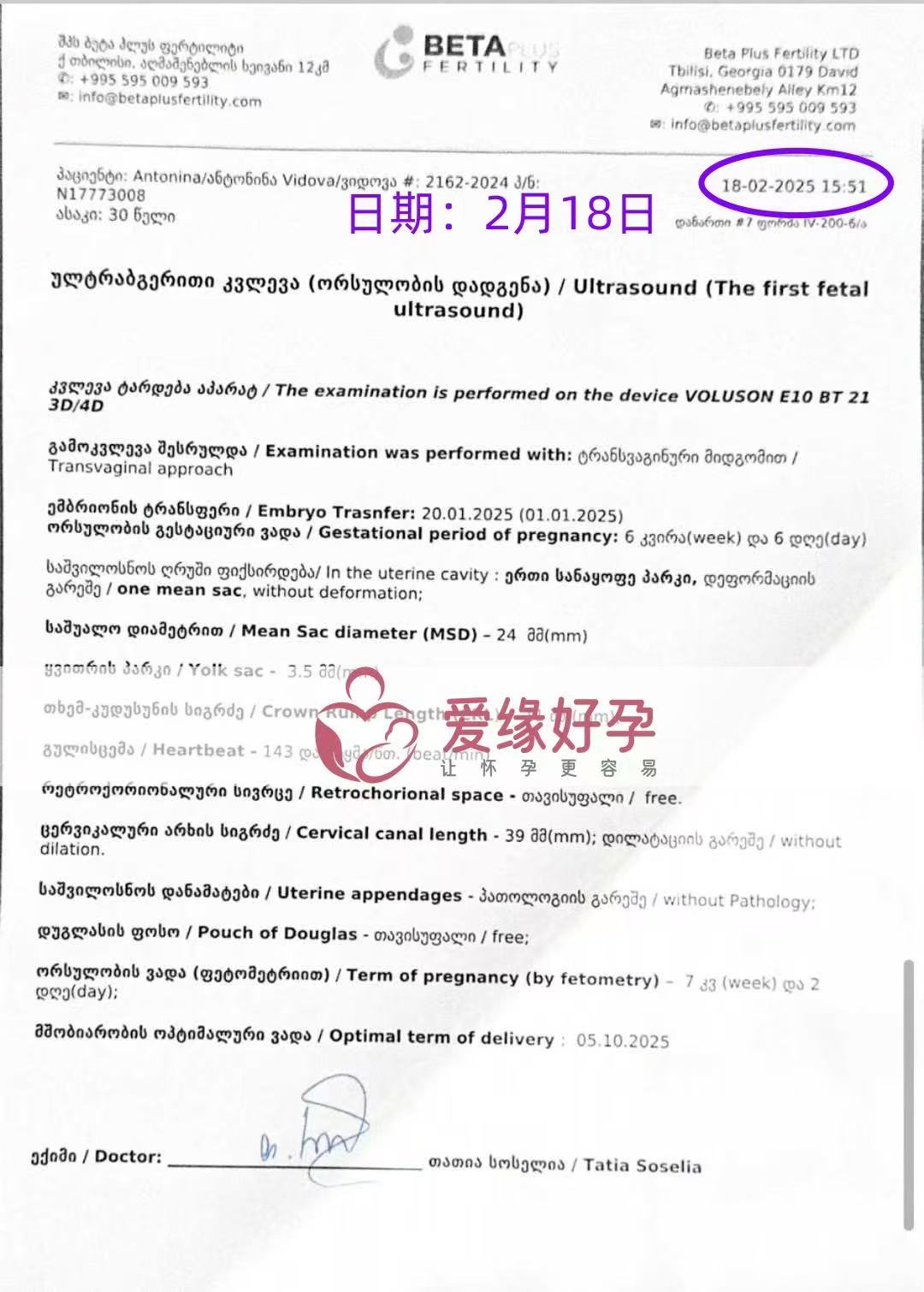 格鲁吉亚试管婴儿助孕爱心使者6周第一次产检完美通过