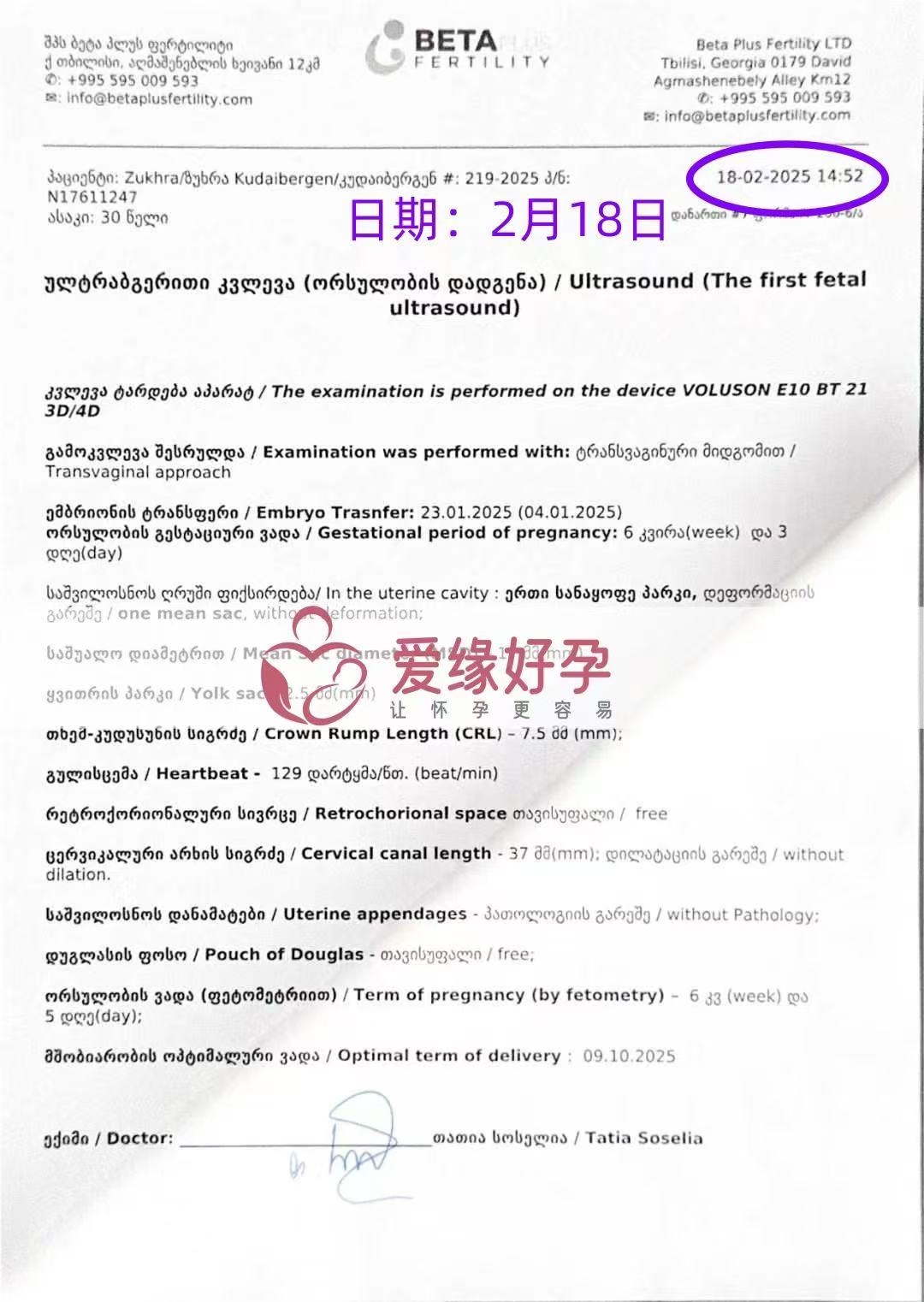 格鲁吉亚试管婴儿助孕爱心使者6周产检通过，孕期迈出第一步