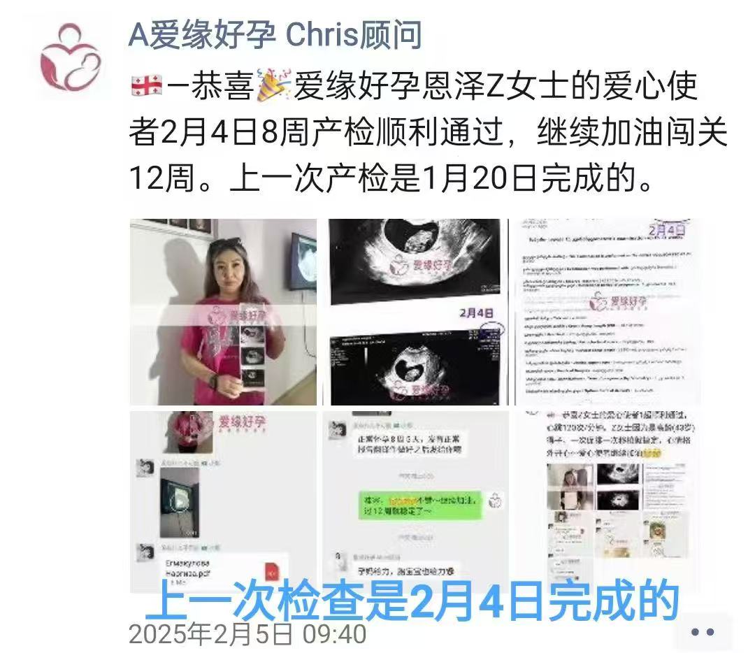 格鲁吉亚试管婴儿助孕爱心使者10周产检顺利通过