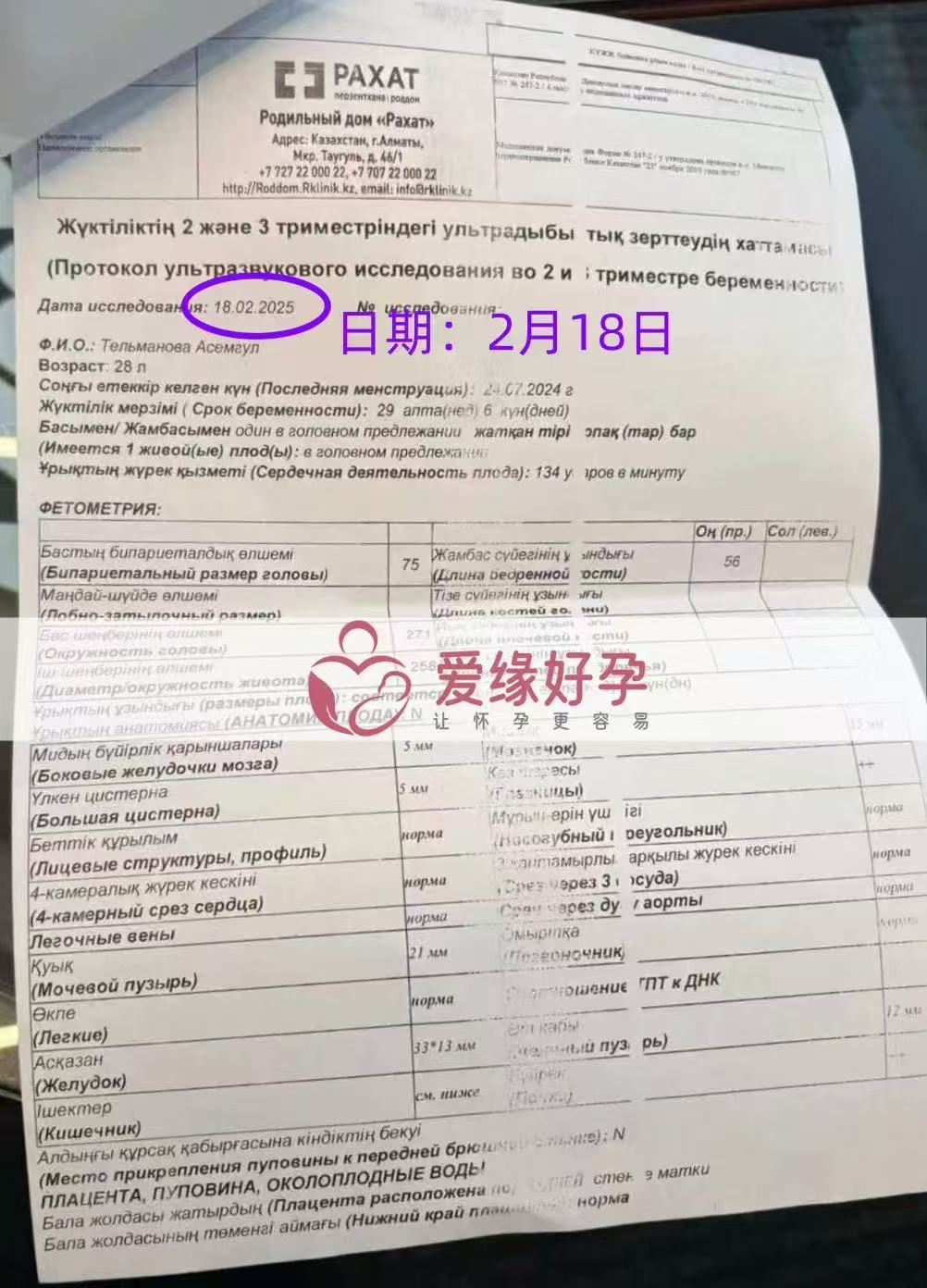 格鲁吉亚试管婴儿助孕爱心使者29周产检过关，孕期进展顺利
