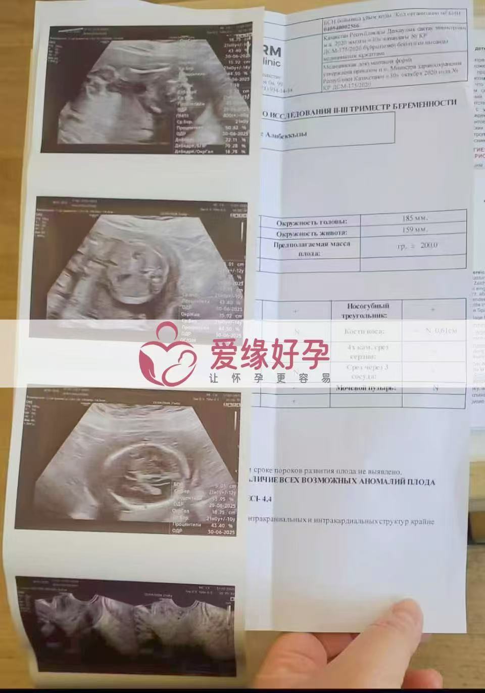 哈萨克斯坦试管婴儿助孕爱心使者21周产检顺利通过