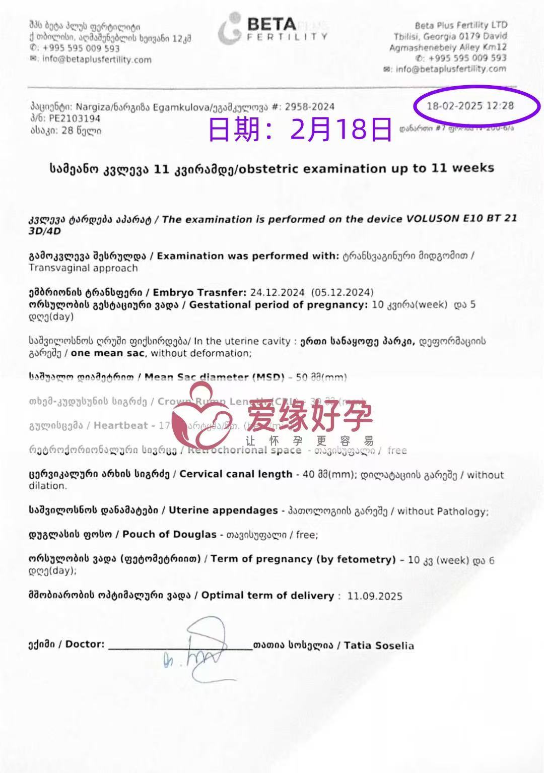 格鲁吉亚试管婴儿助孕爱心使者10周产检顺利通过