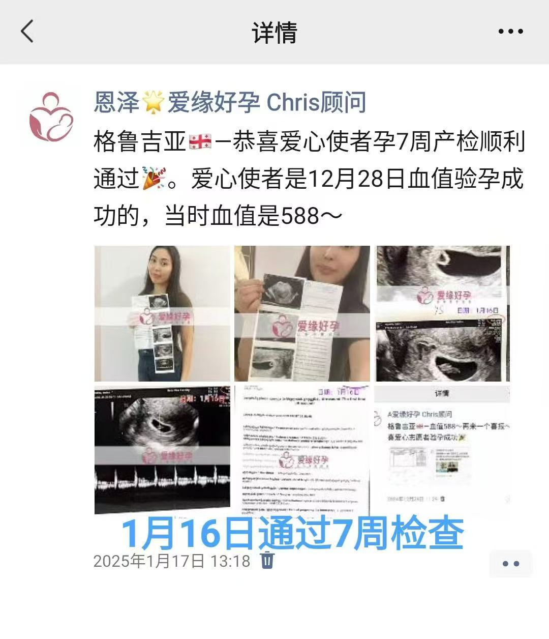 格鲁吉亚试管婴儿助孕爱心使者顺利通过12周检查，正式进入稳定期