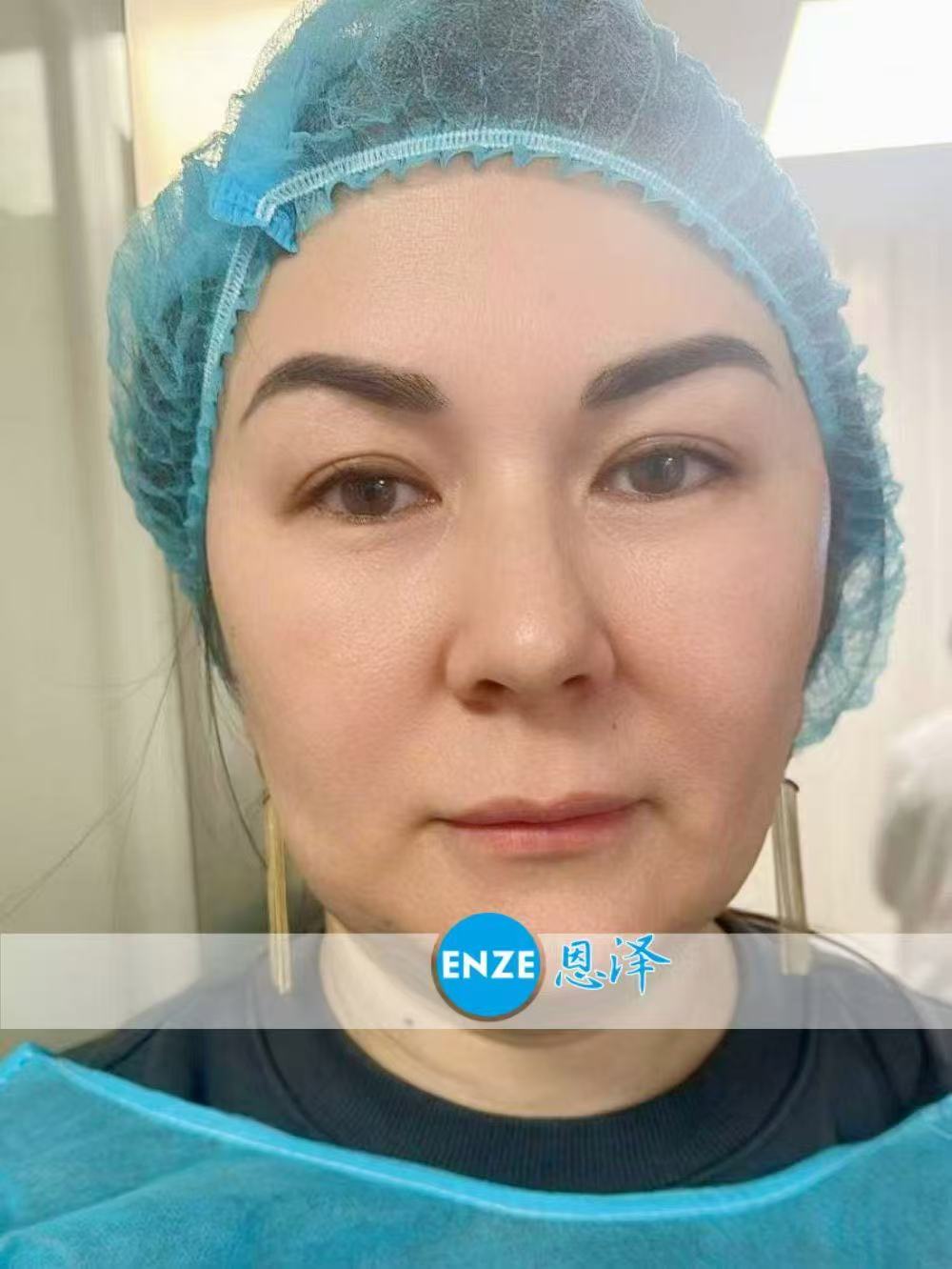 格鲁吉亚试管婴儿助孕爱心使者成功完成移植