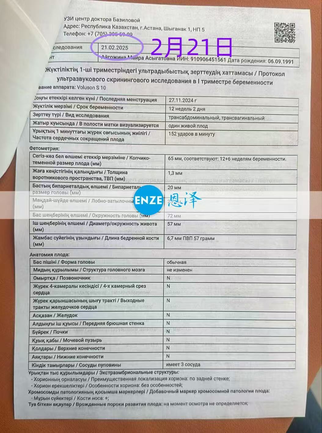 格鲁吉亚试管婴儿助孕爱心使者顺利通过12周检查，正式进入稳定期
