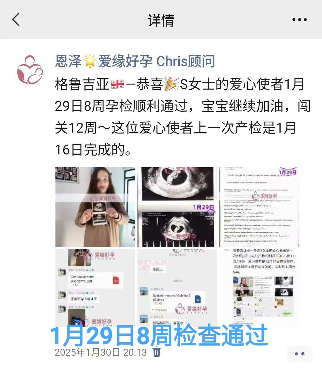 格鲁吉亚试管婴儿助孕爱心使者12周检查通过，迎来稳定期