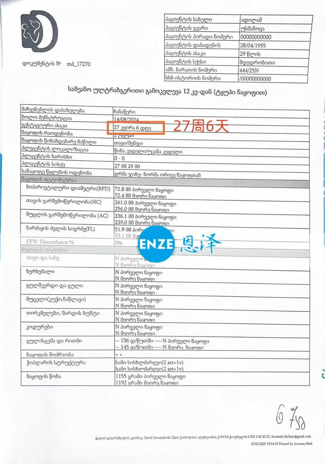 格鲁吉亚试管婴儿助孕爱心使者27周产检顺利通过