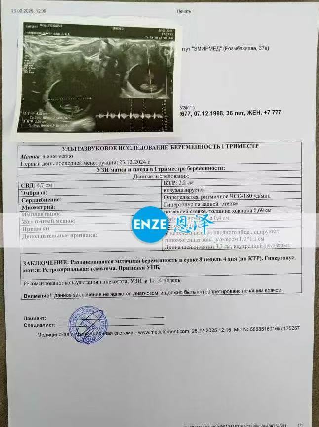 格鲁吉亚试管婴儿助孕爱心使者8周+4天产检顺利通过