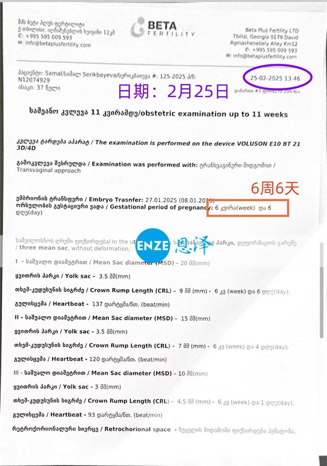 格鲁吉亚试管婴儿助孕爱心使者同暖三胞胎6周检查顺利通过